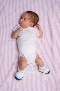 bebé con pies zambos
